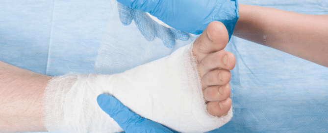 Treating a broken (fractured) ankle