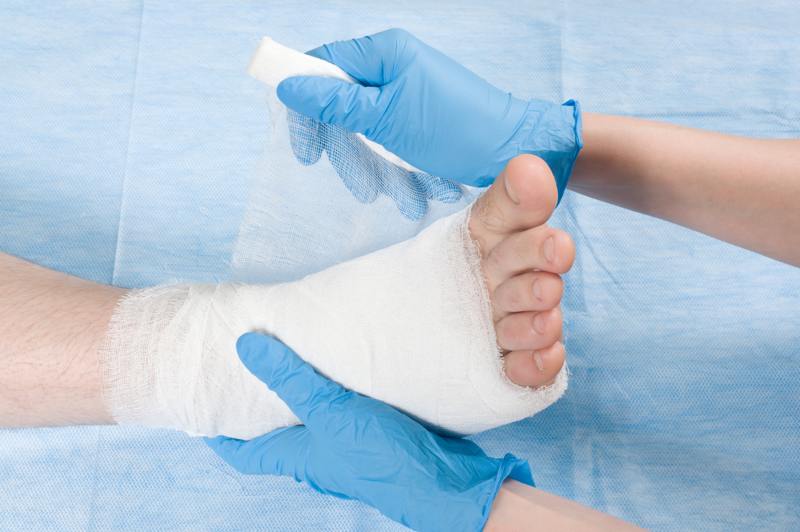 Treating a broken (fractured) ankle